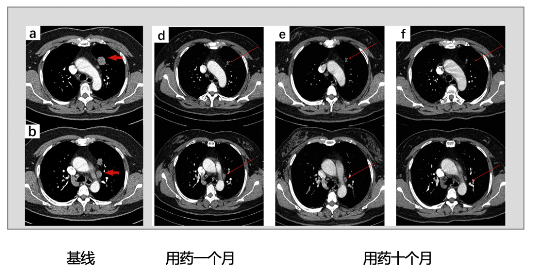 1657500263669961.png 微信圖片_20220711084111.png